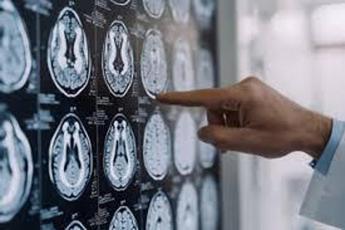 "Parkinson: approvata in Europa nuova formulazione orale Ld/Cd"