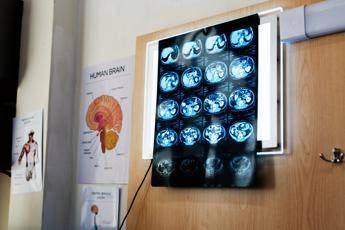 "11 anni di chemio per un tumore inesistente: la verità shock"