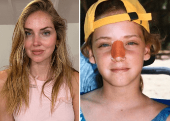 "Chiara Ferragni svela il motivo del suo naso storto"