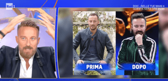 "Francesco Facchinetti sulla calvizie: 'La mia pace con una patch'"