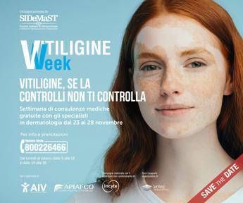 "Vitiligine Week: 1000 Consulenze Dermatologiche Gratuite!"